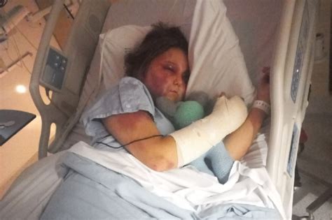 kirra hart getting beat up video|13yo allegedly tortured by teen girls in Sunshine Coast speaks